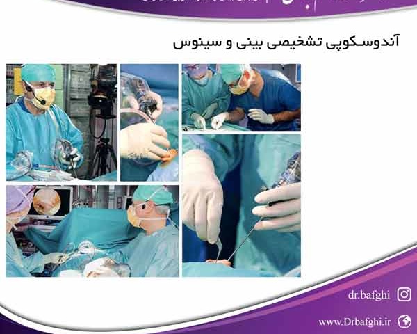 آندوسکوپی تشخیصی بینی و سینوس دکتر احمد ناظم بافقی