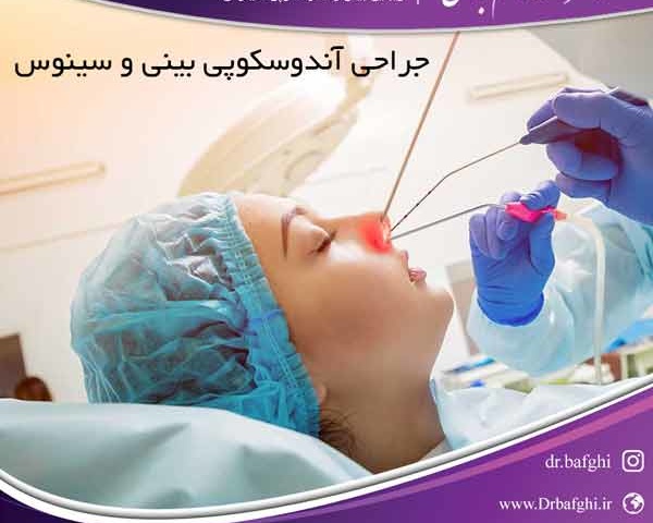 جراحی آندوسکوپی بینی و سینوس دکتر احمد ناظم بافقی
